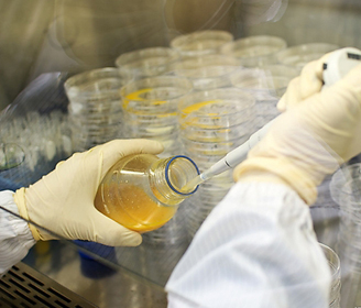 乳腺導(dǎo)管擴(kuò)張癥是什么病？