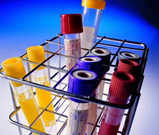 女性更年期莫亂服鎮痛藥